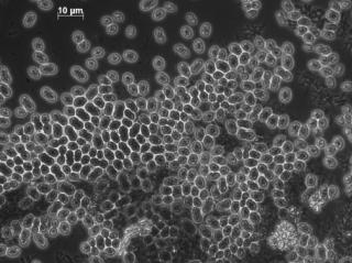 Microscoopfoto van een bioplastic producerende microbi&euml;le populatie uit de pilot reactor van Paques. De kleine bolletjes in de cellen bestaan uit het bioplastic PHA