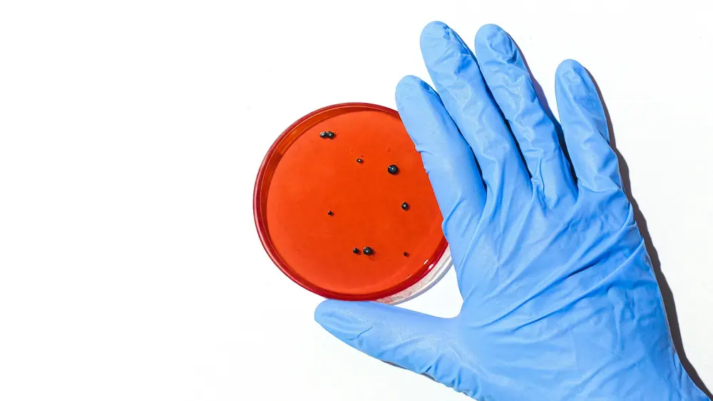 De aanwezigheid van listeria is - net zoals vele andere bacteriën - onlosmakelijk verboden met het werken met voedsel