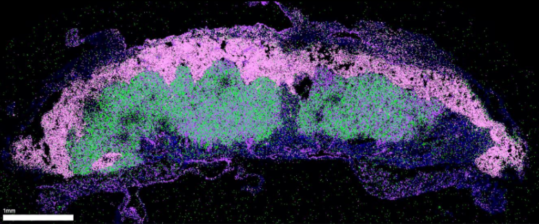 placenta TRPV2 protéine