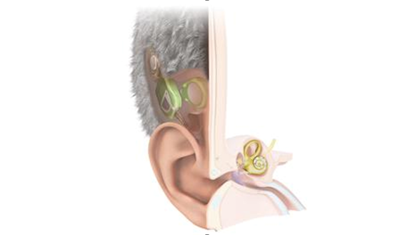 Cochleair implantaat