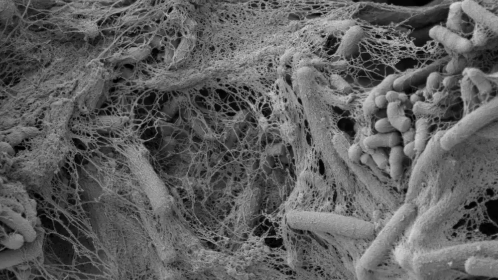 Microscopiebeeld biofilms