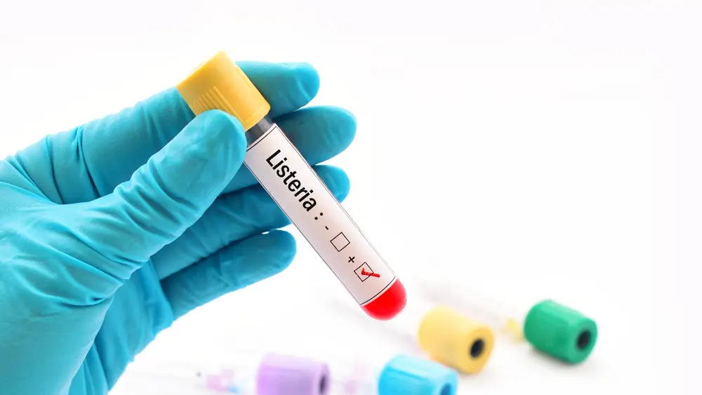 reiniging desinfectie vochtbeheersing