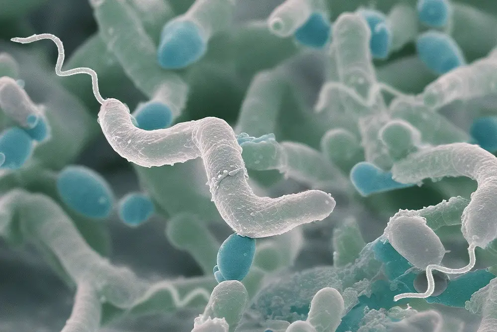 Milde conservering foto 3