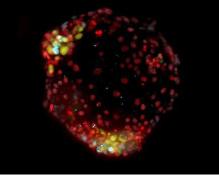 Maastricht: des scientifiques cultivent le premier embryon synthétique de jumeau humain