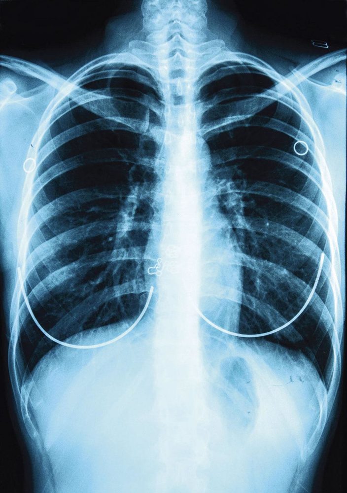 Stop gevaarlijke overconsumptie van corticosteroïden