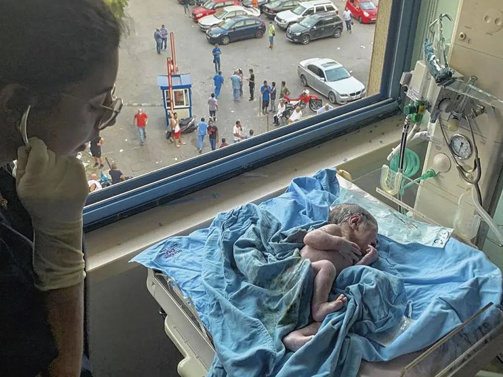 100 stageplaatsen gezocht voor Libanese artsen