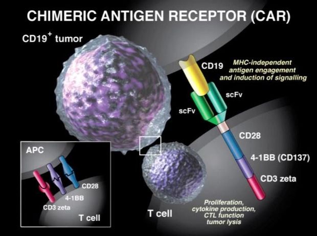 Immunotherapie met CAR-T-cellen bij glioblastoom: eerste, spectaculaire resultaten