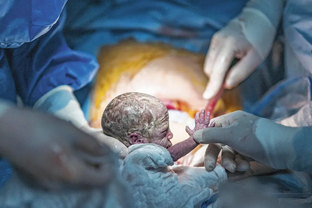 L'accueil d'un bébé prématuré (un des triplés), dans la plus grande douceur et bienveillance médicale possible. © Marc Trippaerts.