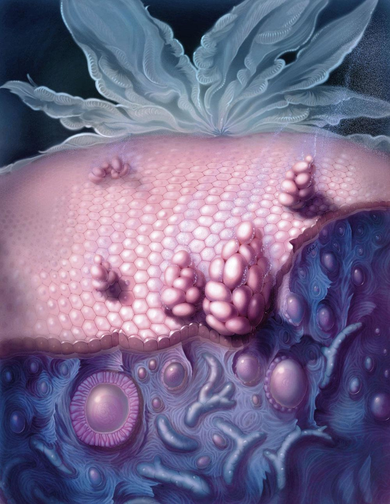 Gevorderde ovariumkanker: veranderd paradigma bevestigd, maar welk therapeutisch beleid nu?