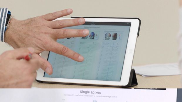 Epilepsie sneller vaststellen
