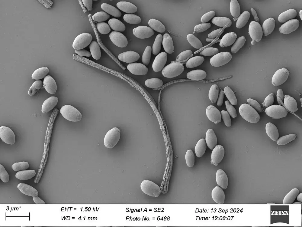 Onder microscoop 2