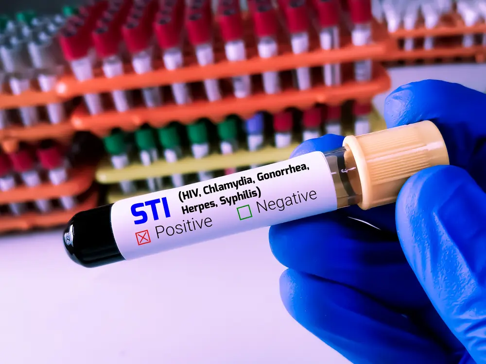 hiv