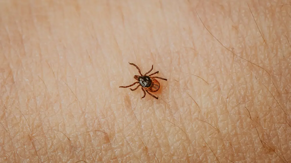 Tekenbeet, lyme, sciensano, teken