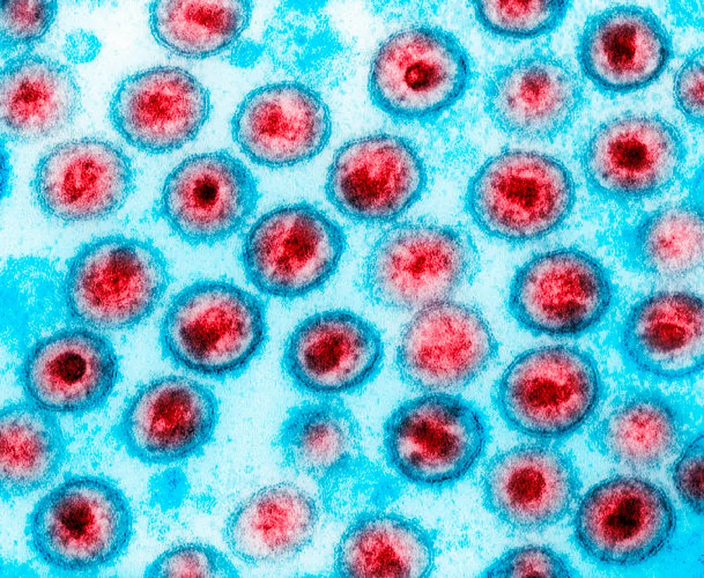 hiv