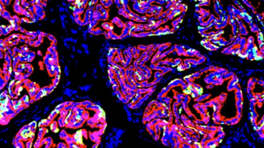 Article Thumbnail