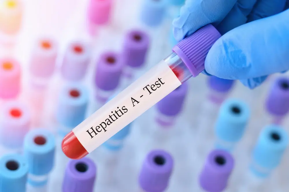hepatitis A-infectie