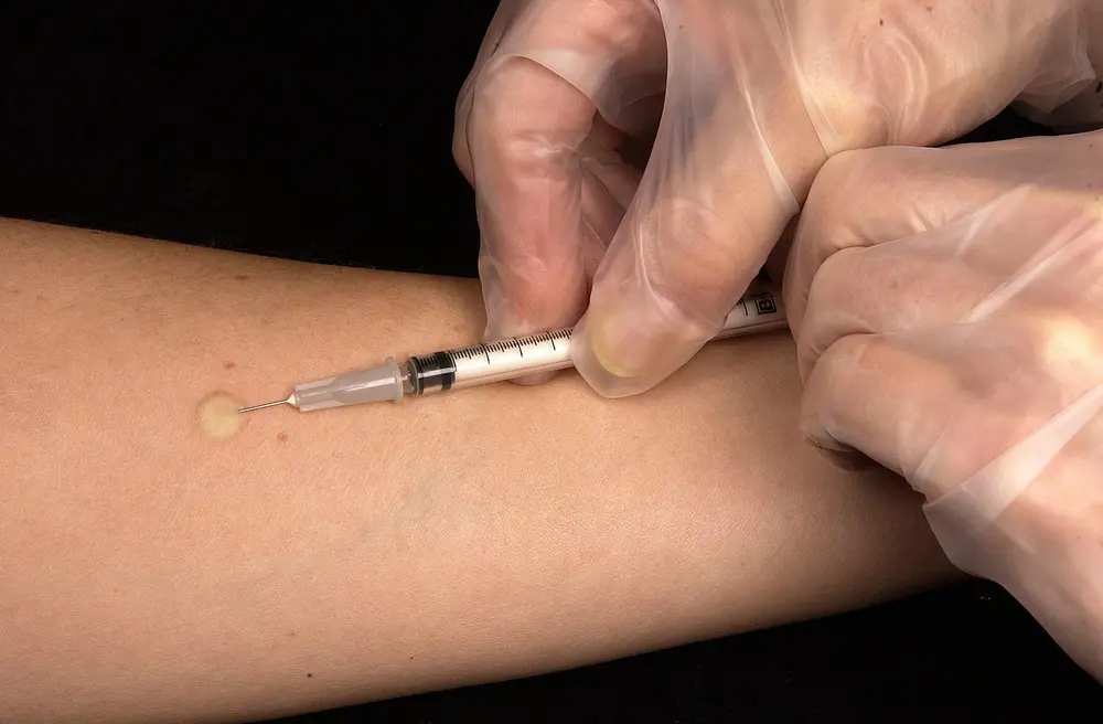 Vaccination dans le bras