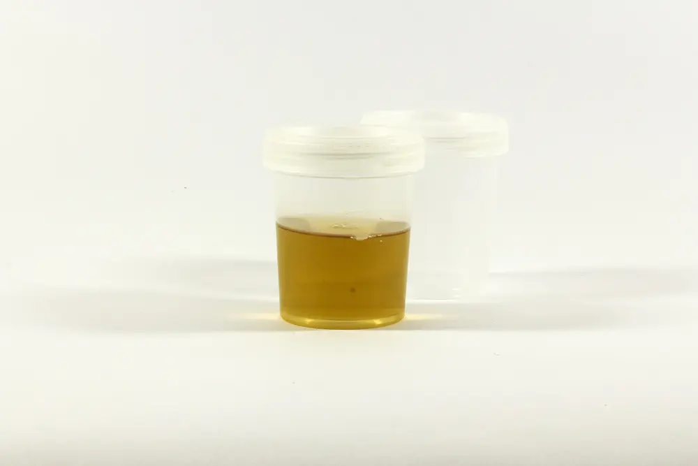 Test échantillon urine