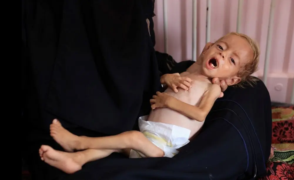 Famine à Gaza - enfant