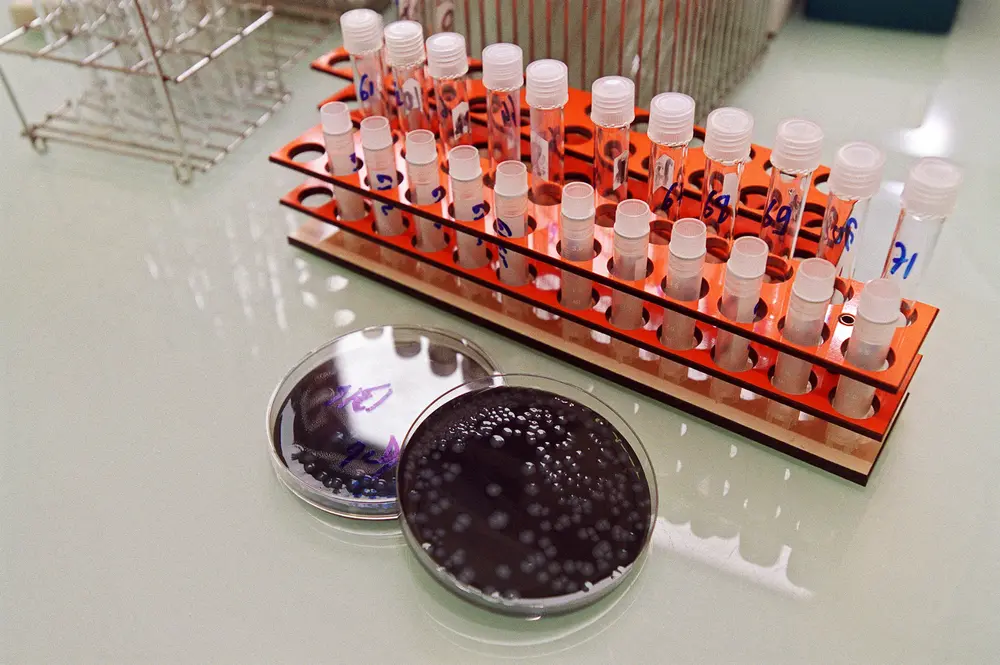 legionella bacterie en culture