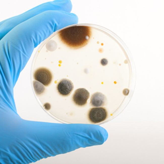 Microbiologische veiligheid2