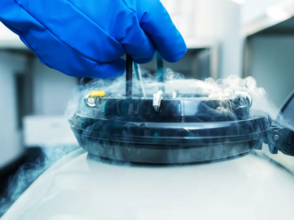 congélation ovocytes sperme