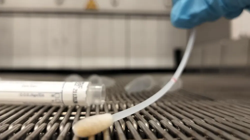 voedselcrises het best worden beheerd?3