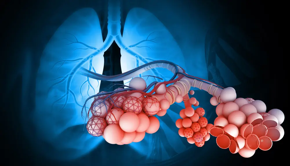fibrose pulmonaire idiopathique