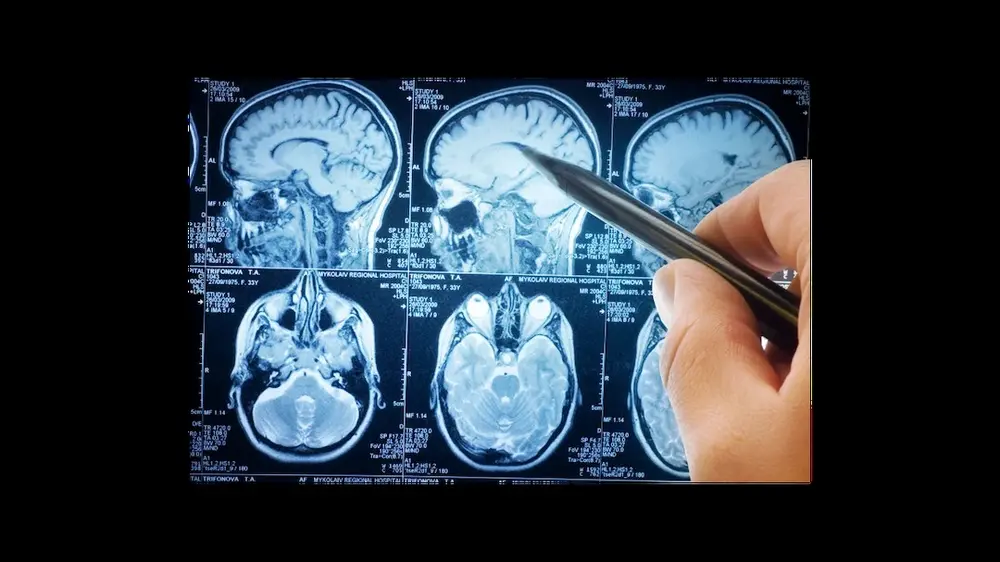 découverte VIB KU Leuven