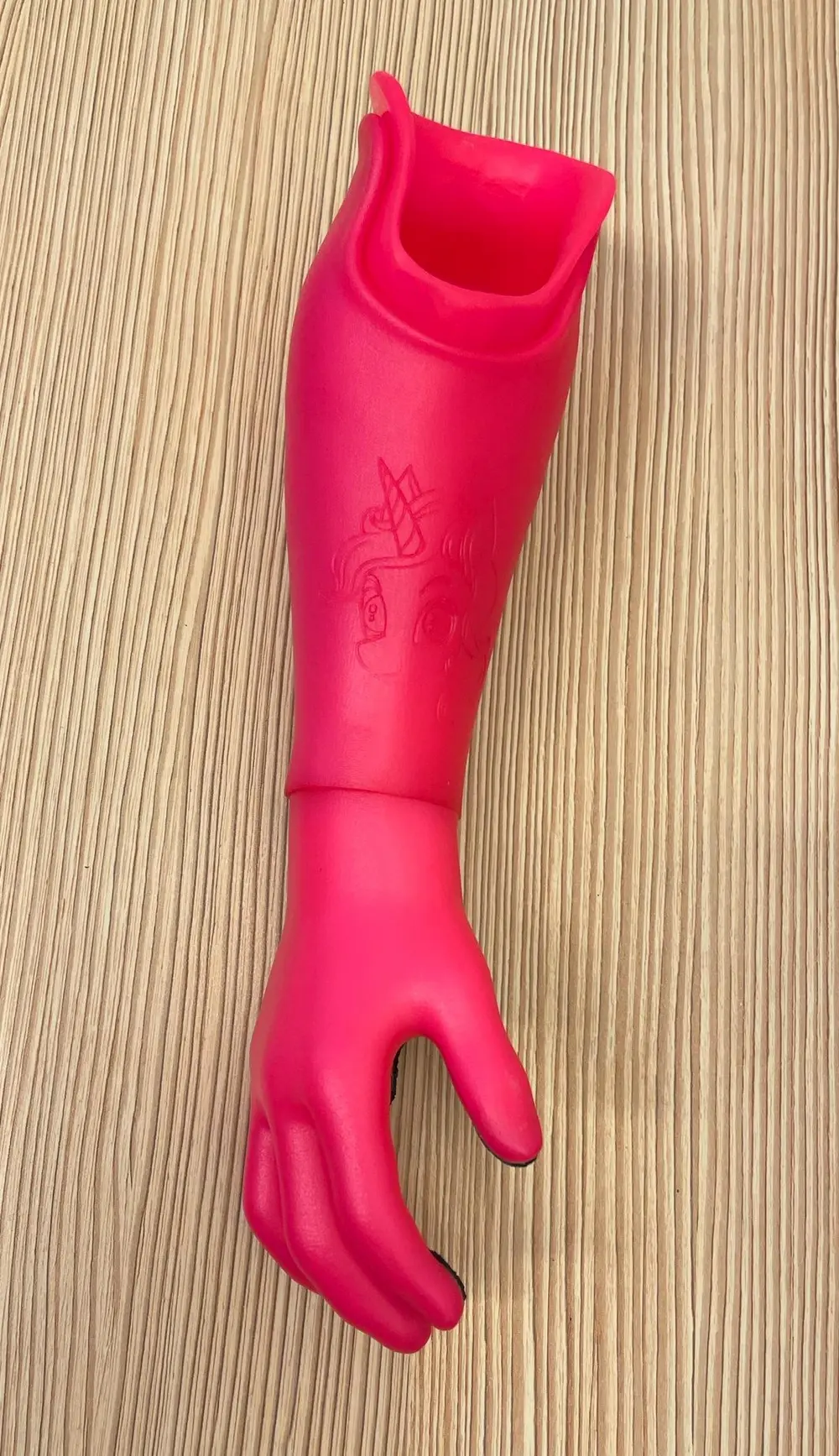 Foto 3: Een functionele onderarm- en handorthese. 