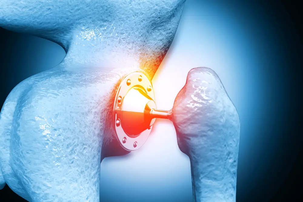 prothèse hanche infections