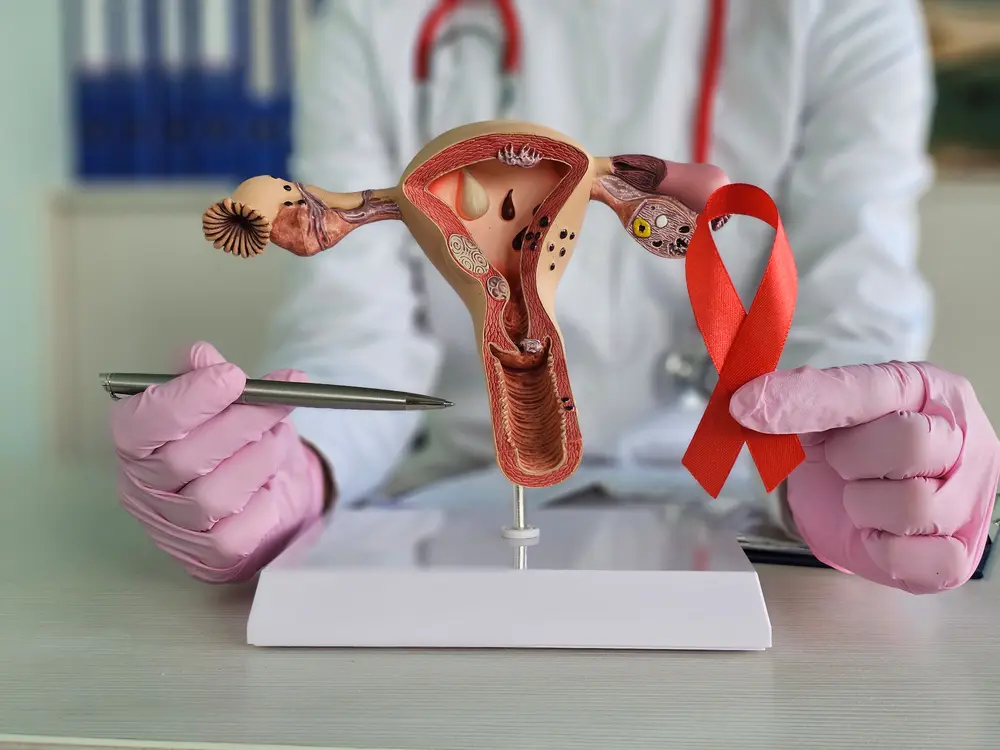 cancer du col de l'utérus