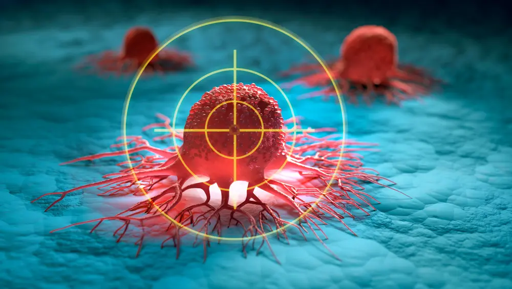 cancer traitements perso