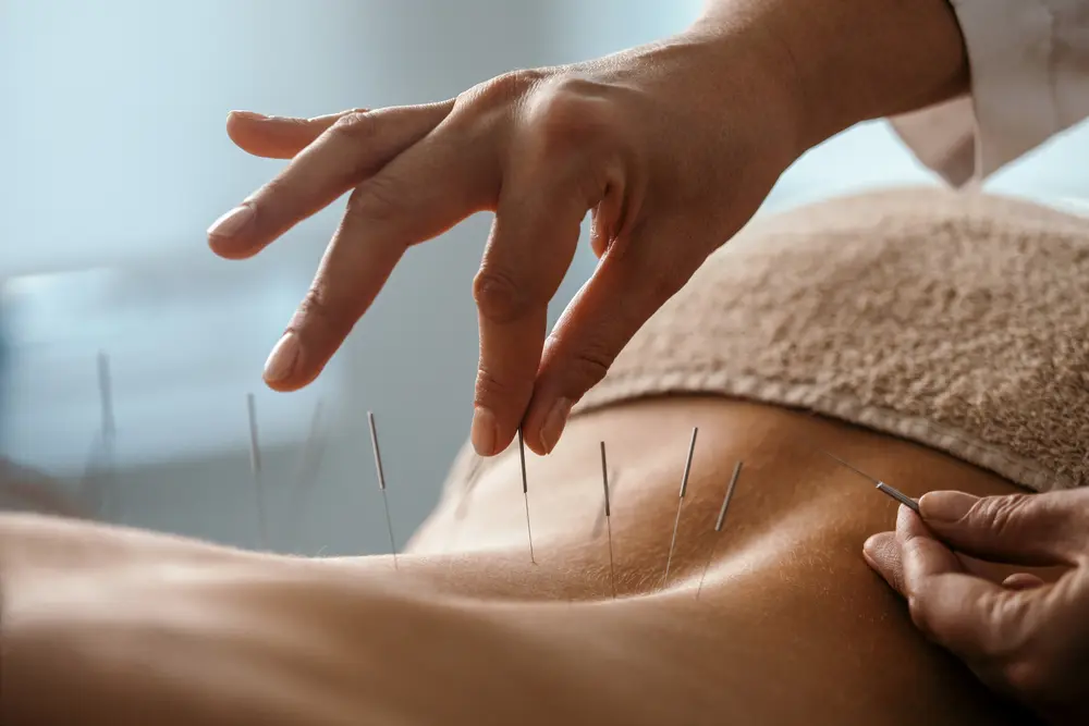 Acupuncture Loi Colla