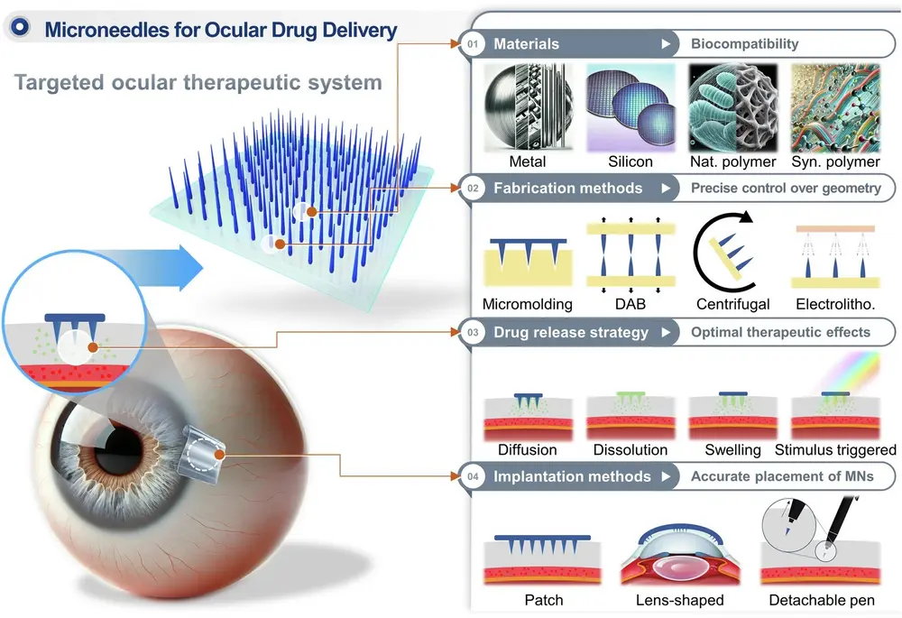 Pleisters met micronaaldjes, een mini-invasief alternatief voor intravitreale injectie