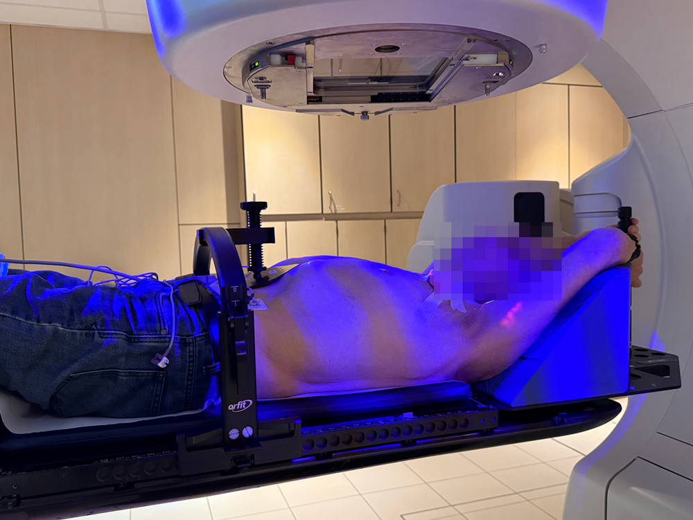 Bestraling tegen hartritmestoornissen