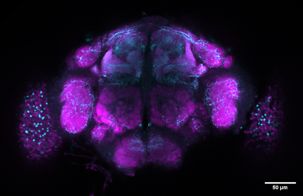 Drosophila brain