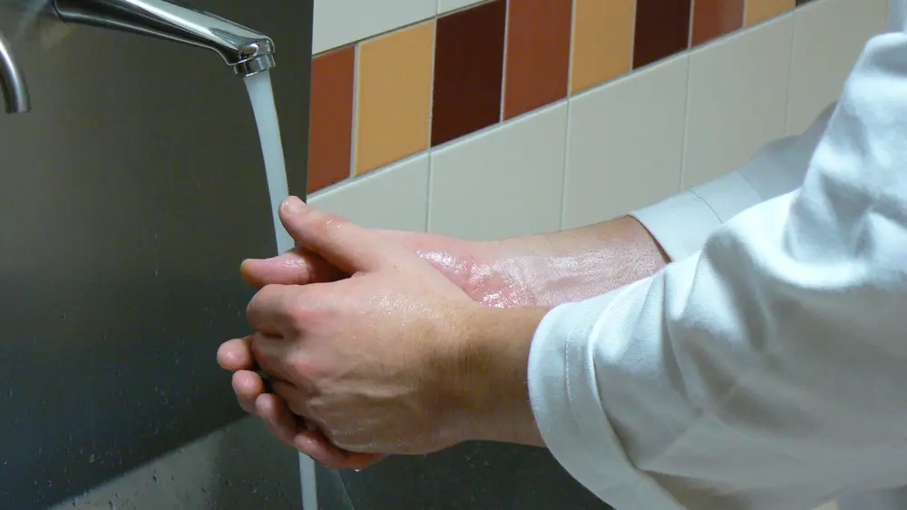 Handhygiëne betekent niet alleen het zuiver maken van de handen, maar ook het gezond houden van de huid